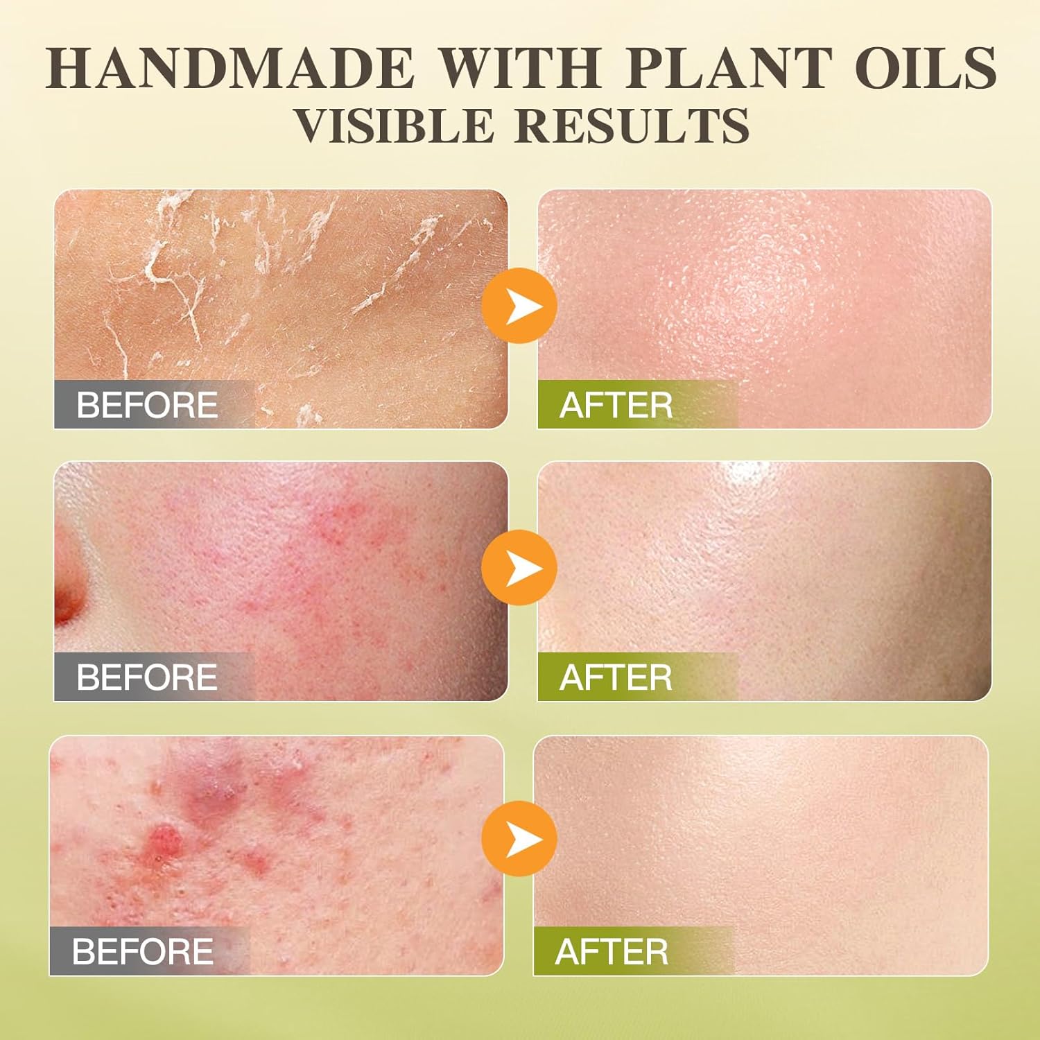 Organic Beef Tallow Honey Balm  150ml (5.3 oz)